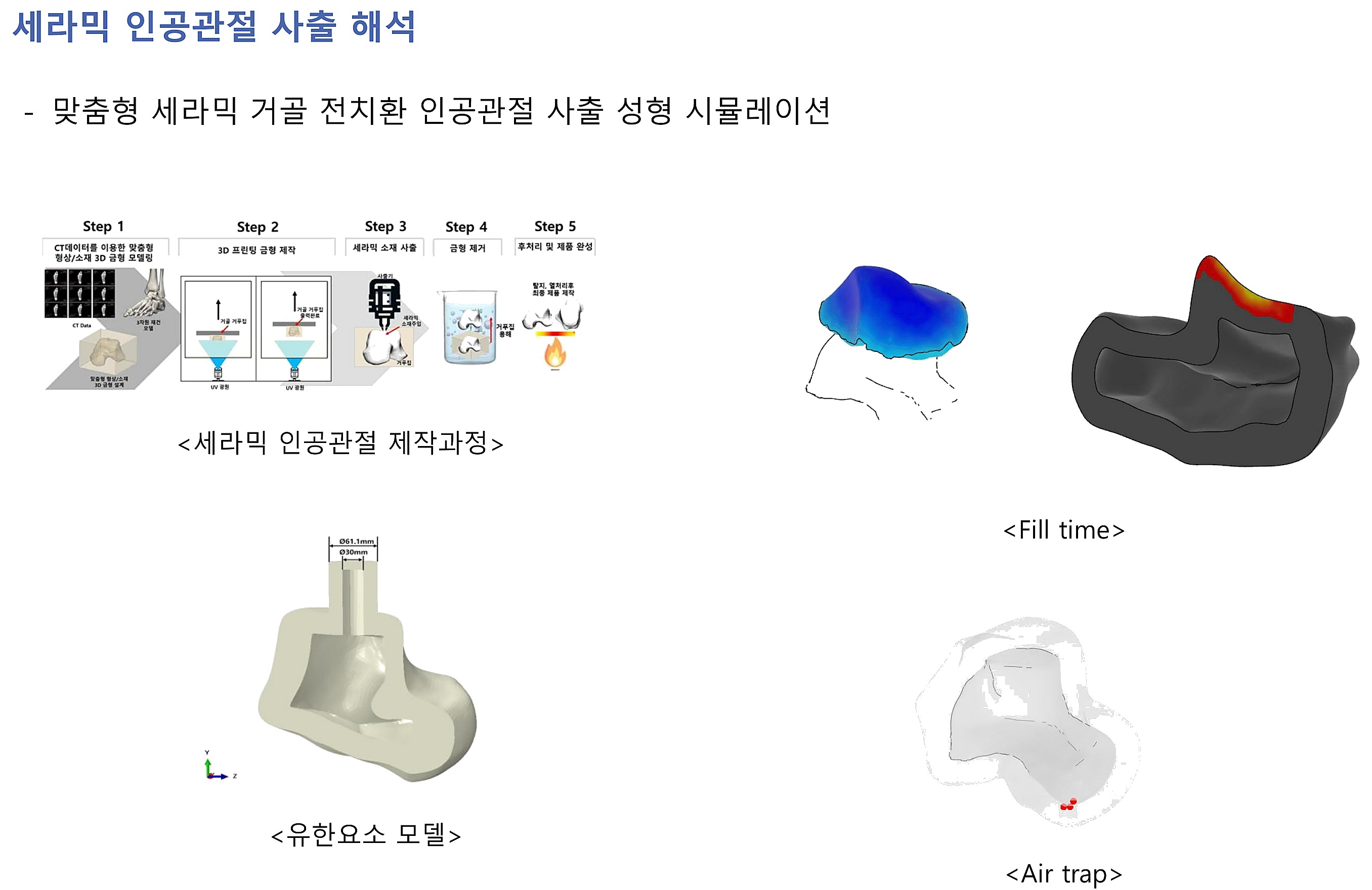 세라믹 인공관절 사출 해석